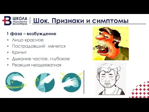 Шок. Признаки и симптомы 1 фаза – возбуждение Лицо красное