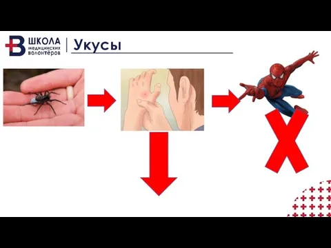 Укусы