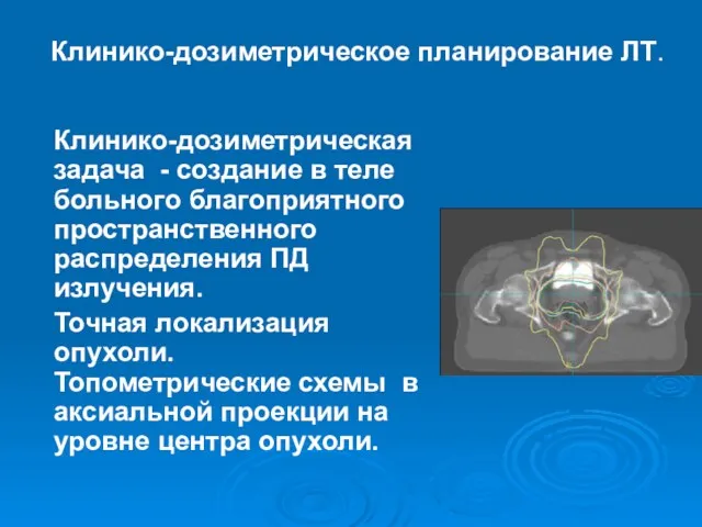 Клинико-дозиметрическое планирование ЛТ. Клинико-дозиметрическая задача - создание в теле больного