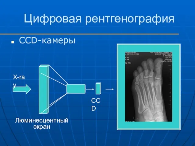 Цифровая рентгенография CCD-камеры Люминесцентный экран CCD