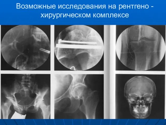 Возможные исследования на рентгено - хирургическом комплексе