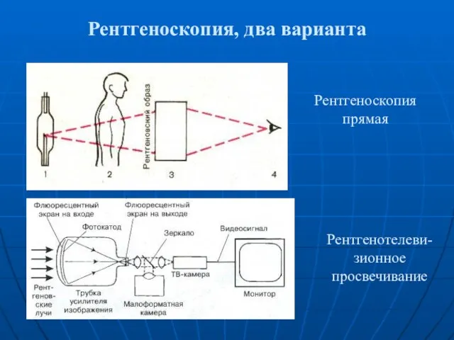 Рентгеноскопия, два варианта Рентгеноскопия прямая Рентгенотелеви-зионное просвечивание