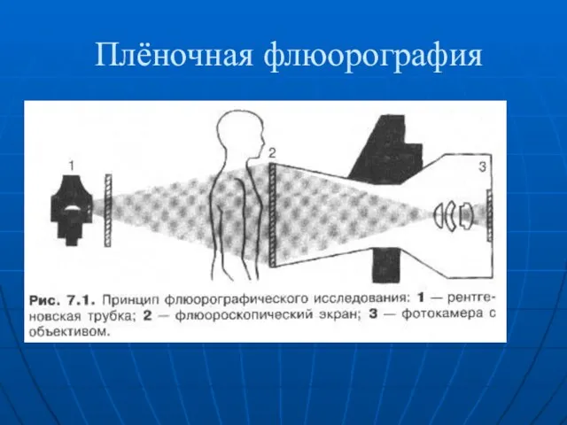 Плёночная флюорография