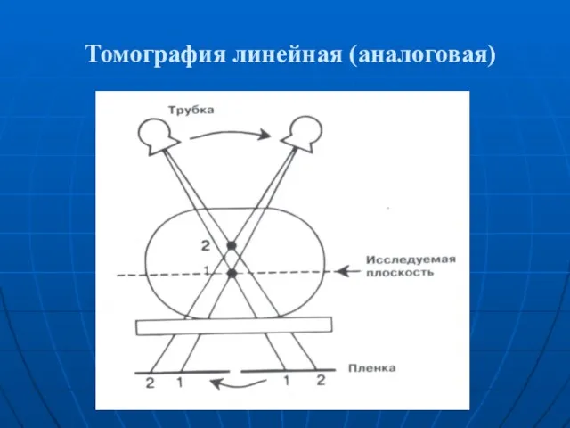 Томография линейная (аналоговая)