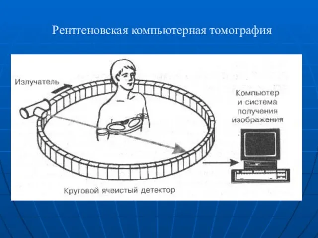 Рентгеновская компьютерная томография