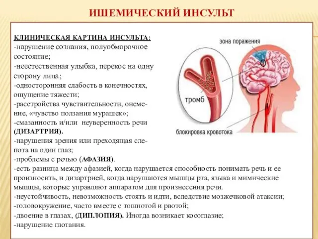 ИШЕМИЧЕСКИЙ ИНСУЛЬТ КЛИНИЧЕСКАЯ КАРТИНА ИНСУЛЬТА: -нарушение сознания, полуобморочное состояние; -неестественная