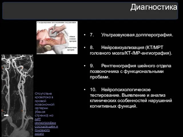 Диагностика 7. Ультразвуковая допплерография. 8. Нейровизуализация (КТ/МРТ головного мозга/КТ-/МР-ангиография). 9. Рентгенография шейного отдела