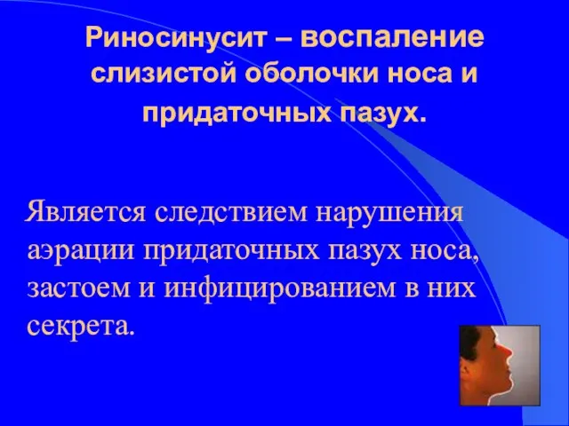 Риносинусит – воспаление слизистой оболочки носа и придаточных пазух. Является