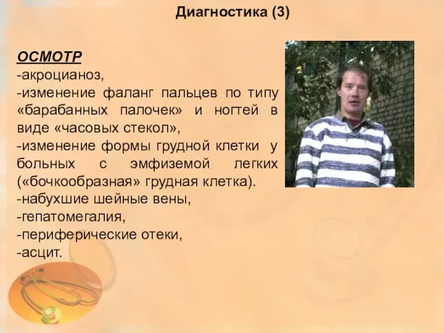 ОСМОТР -акроцианоз, -изменение фаланг пальцев по типу «барабанных палочек» и