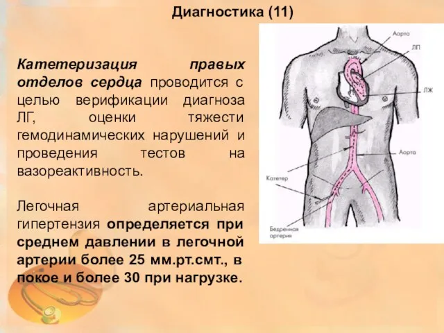 Диагностика (11) Катетеризация правых отделов сердца проводится с целью верификации