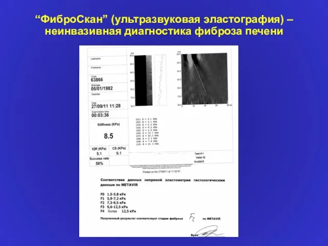 “ФиброCкан” (ультразвуковая эластография) – неинвазивная диагностика фиброза печени