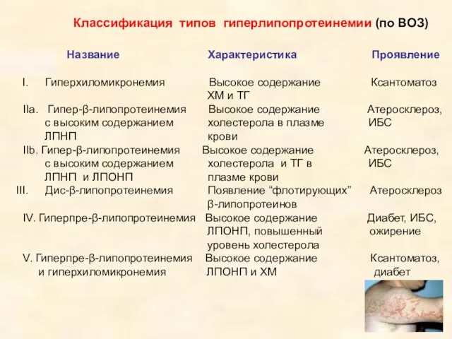 Классификация типов гиперлипопротеинемии (по ВОЗ) Название Характеристика Проявление Гиперхиломикронемия Высокое