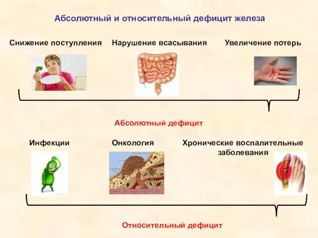 Абсолютный и относительный дефицит железа Абсолютный дефицит Снижение поступления Нарушение