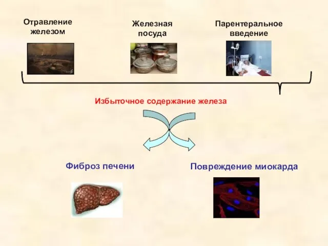 Избыточное содержание железа Отравление железом Железная посуда Парентеральное введение Фиброз печени Повреждение миокарда