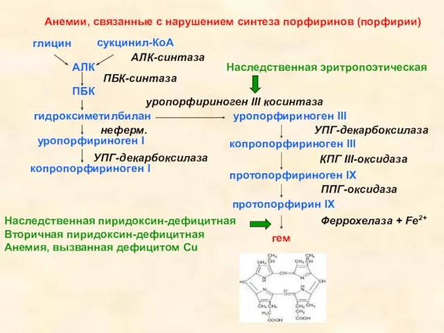 Анемии, связанные с нарушением синтеза порфиринов (порфирии) глицин сукцинил-КоА АЛК