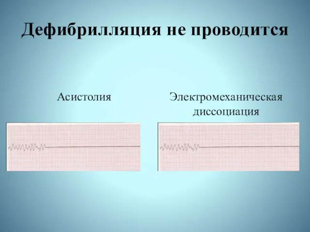 Дефибрилляция не проводится Асистолия Электромеханическая диссоциация