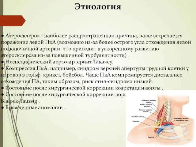 Этиология ● Атеросклероз - наиболее распространенная причина, чаще встречается поражение