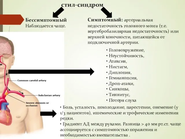 Бессимптомный Наблюдается чаще. стил-синдром • Боль, усталость, похолодание, парестезии, онемение