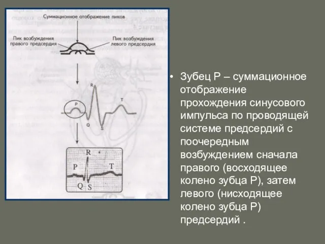 Зубец Р – суммационное отображение прохождения синусового импульса по проводящей