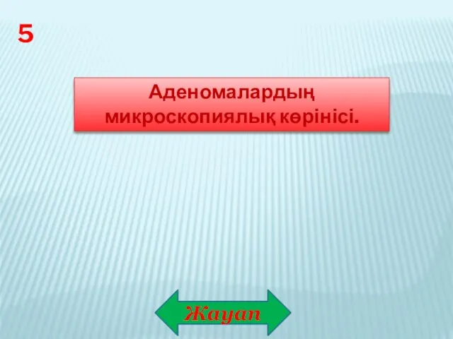 Жауап 5 Аденомалардың микроскопиялық көрінісі.