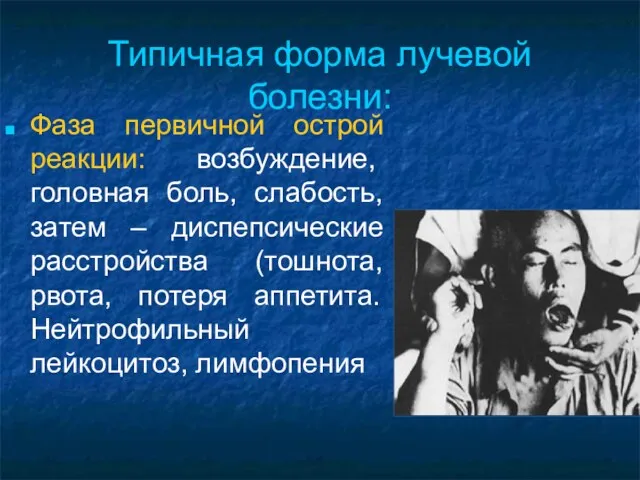 Типичная форма лучевой болезни: Фаза первичной острой реакции: возбуждение, головная