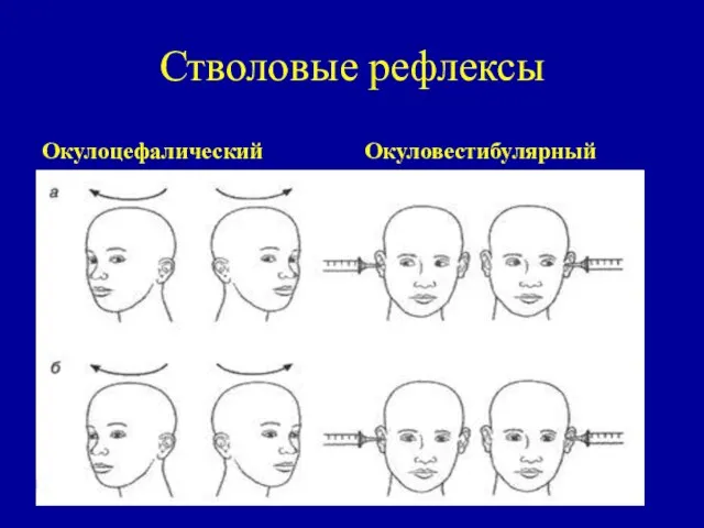 Стволовые рефлексы Окулоцефалический Окуловестибулярный