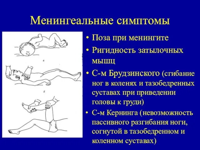 Менингеальные симптомы Поза при менингите Ригидность затылочных мышц С-м Брудзинского