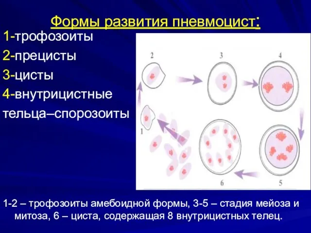 Формы развития пневмоцист: 1-трофозоиты 2-прецисты 3-цисты 4-внутрицистные тельца–спорозоиты 1-2 –