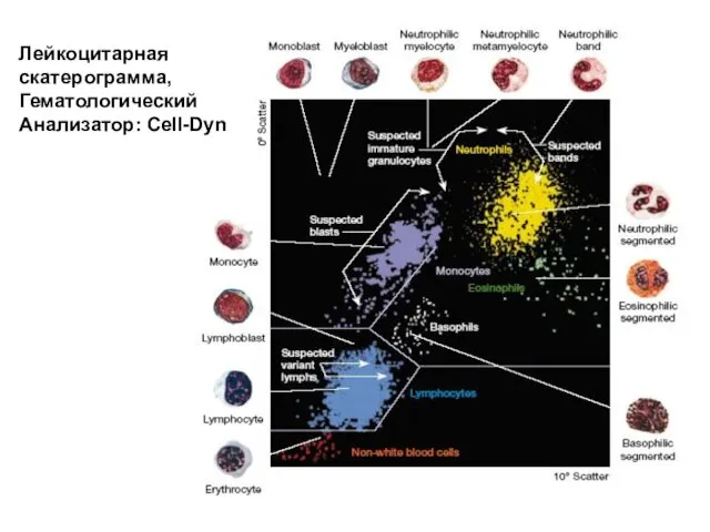 Лейкоцитарная скатерограмма, Гематологический Анализатор: Cell-Dyn