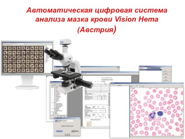 Автоматическая цифровая система анализа мазка крови Vision Hema (Австрия)