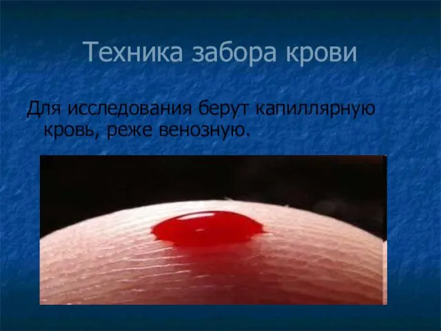 Техника забора крови Для исследования берут капиллярную кровь, реже венозную.