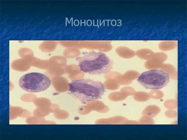 Моноцитоз