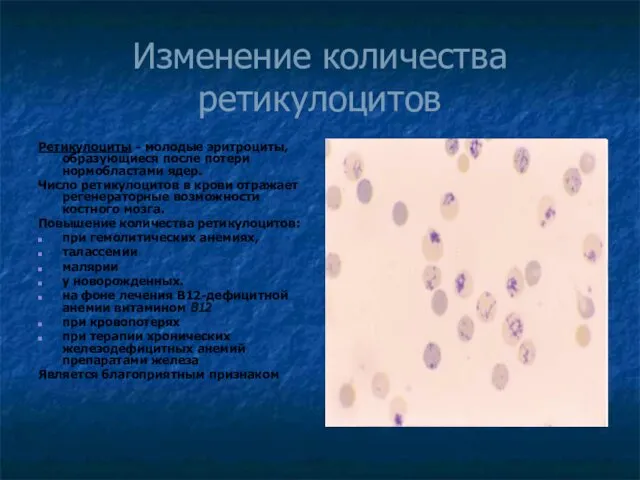 Изменение количества ретикулоцитов Ретикулоциты - молодые эритроциты, образующиеся после потери