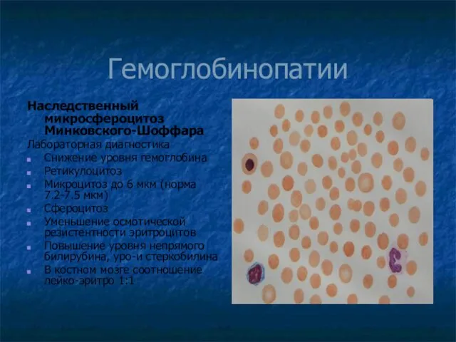 Гемоглобинопатии Наследственный микросфероцитоз Минковского-Шоффара Лабораторная диагностика Снижение уровня гемоглобина Ретикулоцитоз