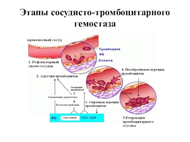 Этапы сосудисто-тромбоцитарного гемостаза