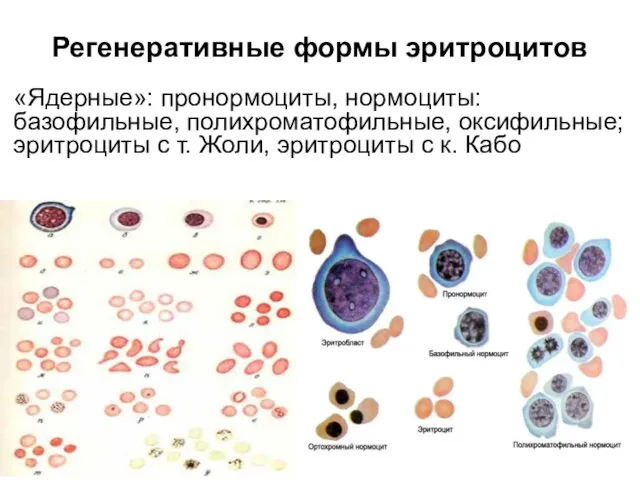 Регенеративные формы эритроцитов «Ядерные»: пронормоциты, нормоциты: базофильные, полихроматофильные, оксифильные; эритроциты