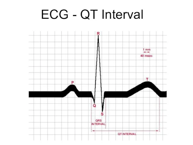 ECG - QT Interval