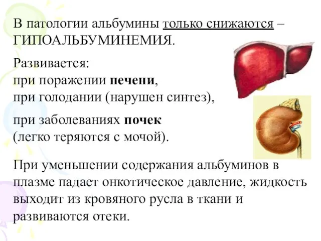 В патологии альбумины только снижаются – ГИПОАЛЬБУМИНЕМИЯ. Развивается: при поражении