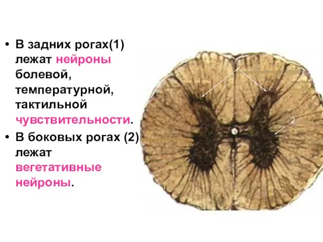 В задних рогах(1) лежат нейроны болевой, температурной, тактильной чувствительности. В