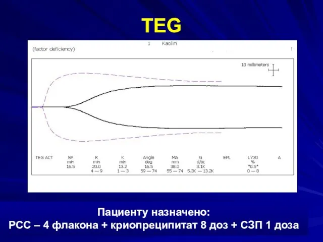 TEG Пациенту назначено: РСС – 4 флакона + криопреципитат 8 доз + СЗП 1 доза