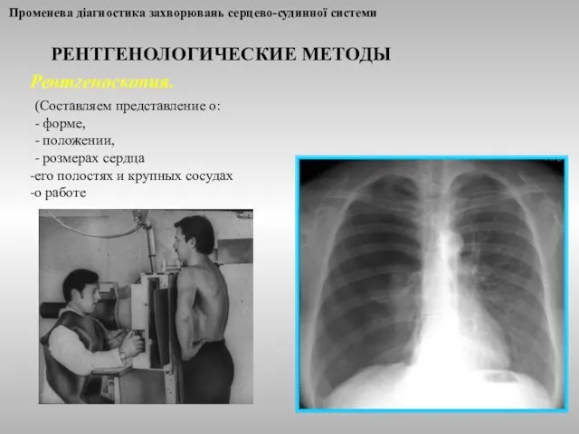 Променева діагностика захворювань серцево-судинної системи РЕНТГЕНОЛОГИЧЕСКИЕ МЕТОДЫ Рентгеноскопия. (Составляем представление