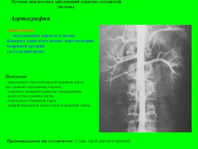 Лучевая диагностика заболеваний сердечно-сосудистой системы Аортография Аортография — исследование аорты