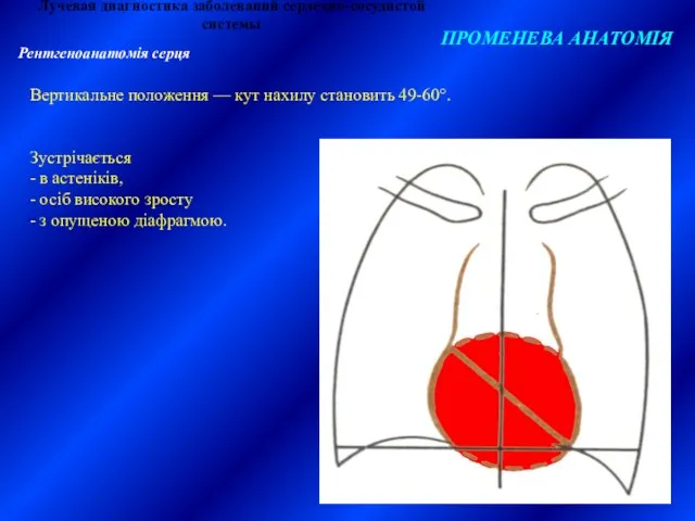 Лучевая диагностика заболеваний сердечно-сосудистой системы ПРОМЕНЕВА АНАТОМІЯ Рентгеноанатомія серця Вертикальне