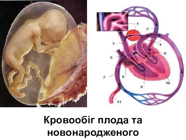 Кровообіг плода та новонародженого