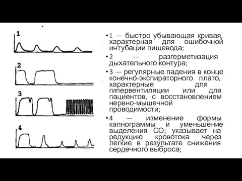 1 — быстро убывающая кривая, характерная для ошибочной интубации пищевода; 2 — разгерметизация