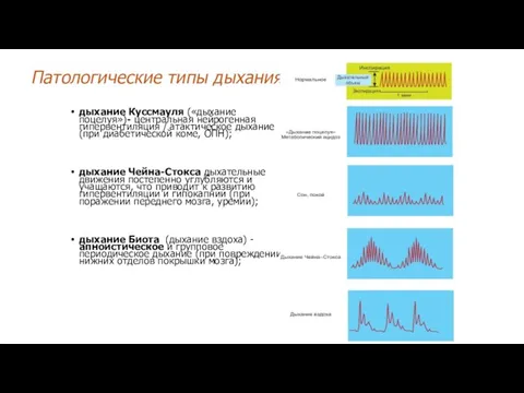 Патологические типы дыхания дыхание Куссмауля («дыхание поцелуя»)- центральная нейрогенная гипервентиляция / атактическое дыхание