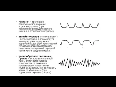 гаспинг - групповое периодическое дыхание агонального типа (при повреждении продолговатого мозга и в