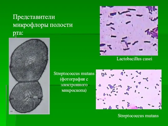 Представители микрофлоры полости рта: Lactobacillus casei Streptococcus mutans Streptococcus mutans (фотография с электронного микроскопа)