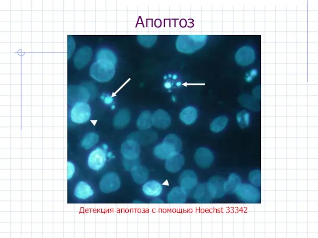 Апоптоз Детекция апоптоза с помощью Hoechst 33342