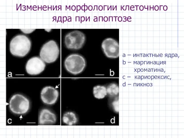 Изменения морфологии клеточного ядра при апоптозе а – интактные ядра,